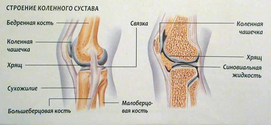 Почему в коленном суставе собирается жидкость? | Вопросы и ответы от Медики